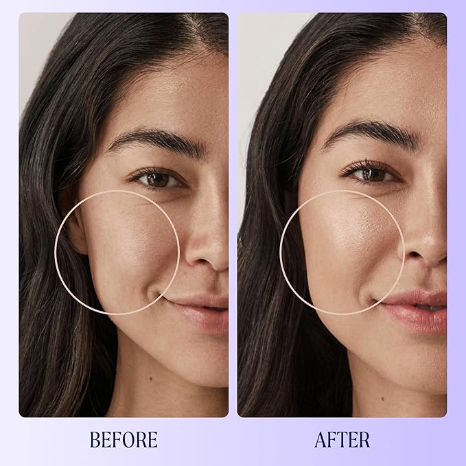 Kinship Zinc Oxide Mineral Sunscreen for Face Self Reflect SPF 32 | Vegan, Reef Safe, Non Toxic Eczema Sunscreen for Sensitive Skin | Sunblock Face Moisturizer with SPF (1.75 oz)-GlimoraGlow