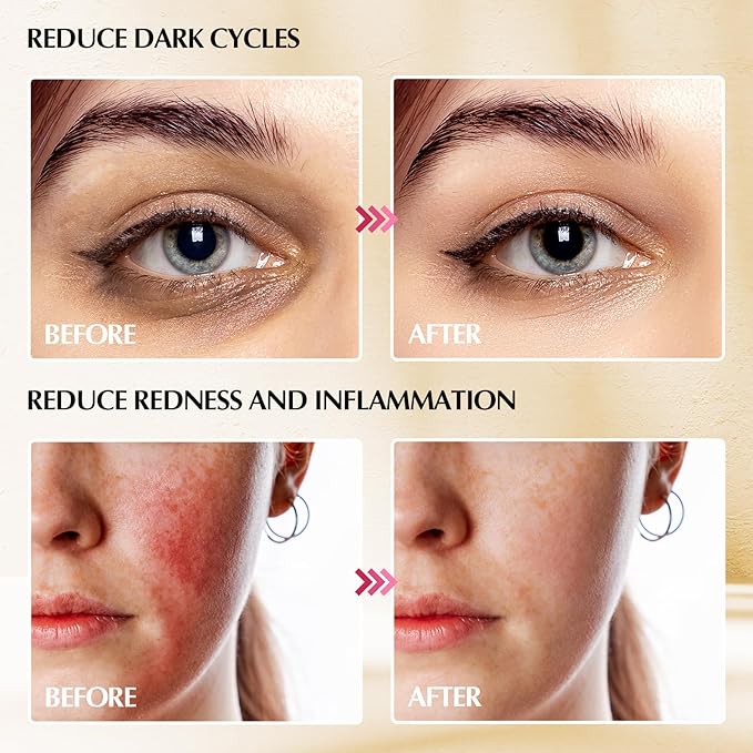 2-in-1 Gua Sha Cryo Sticks, Facial Skin Care Tools for Women Face and Eyes Massage, Unbreakable Stainless Steel Esthetician Supplies, Cooling Spa Ice Globes Roller with Carry Case-GlimoraGlow