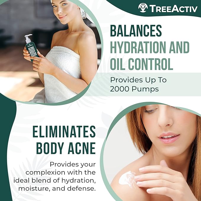 TreeActiv Acne Eliminating Body Lotion 8 fl oz | Clears Body, Back, Butt and Shoulder Acne | Anti-Acne Moisturizer | Prevents Future Breakouts | Cucumber Mint Scent-GlimoraGlow
