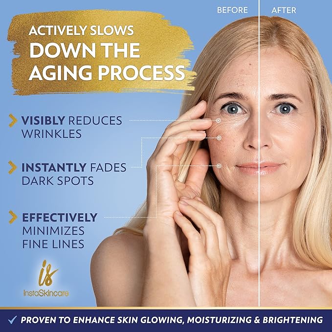 DOUBLE SIZED (2Oz) Niacinamide Serum for Face 10% with Zinc 1% Vitamin B3 Brightening Serum for for Tone, Texture and Hydrating-GlimoraGlow