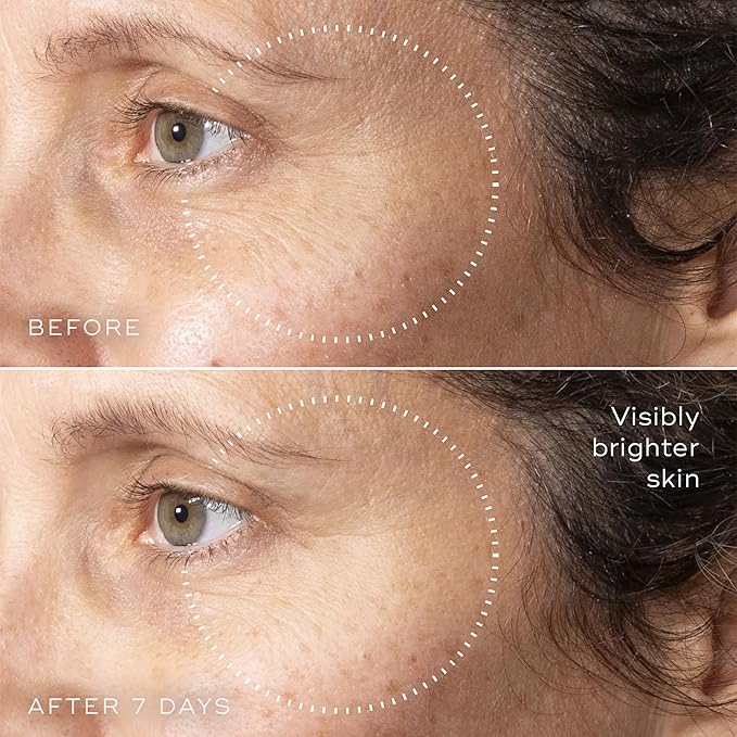 Medik8 C-Tetra Advanced - Balancing, Plumping, Hydrating Daily Vitamin C Serum with Hyaluronic Acid, Squalene - Smooths Fine Lines, Wrinkles - 1.0 oz-GlimoraGlow