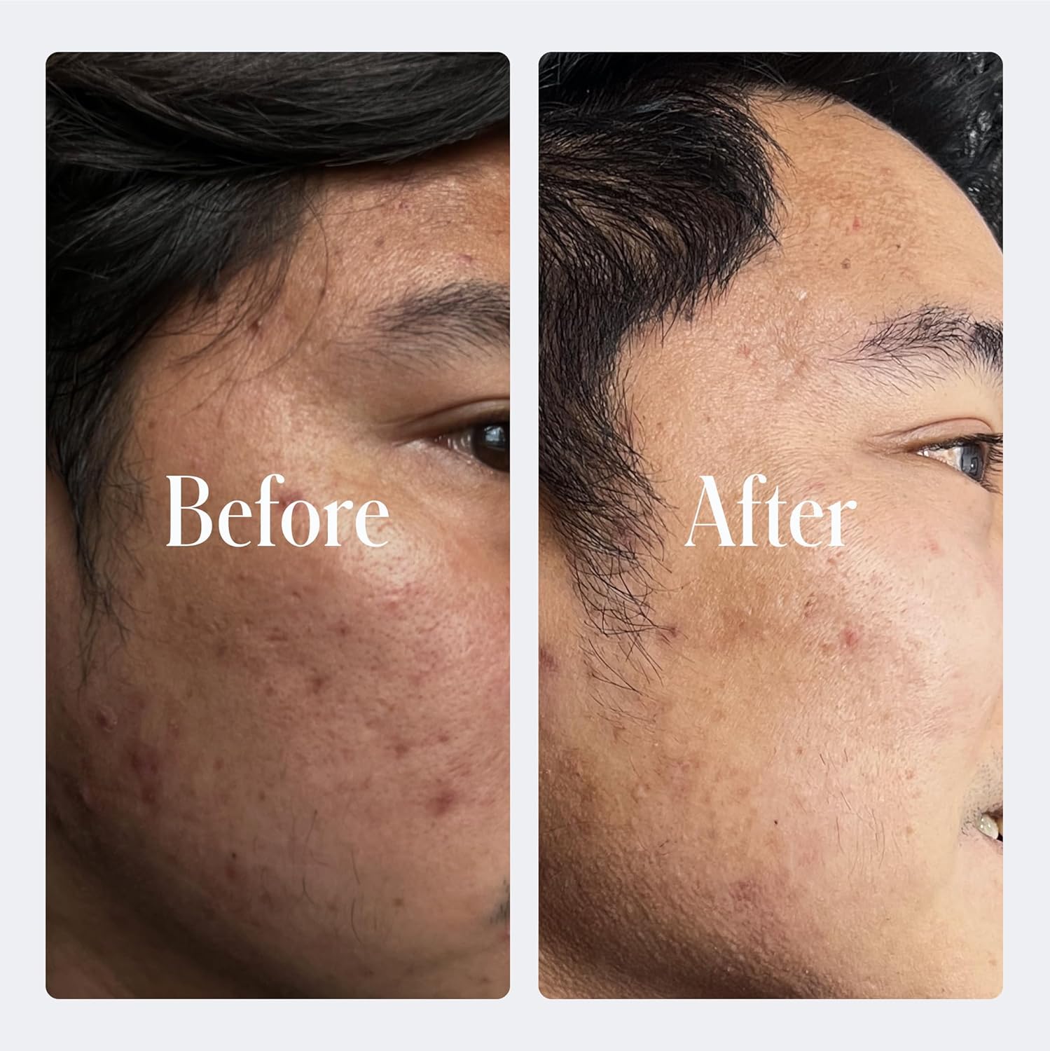 Geologie Retinol Anti-Aging Face Cream | Advanced .3% Retinol Formula for Effective Results | Reduce Fine Lines & Wrinkles | Protect & Repair Skin With Hyaluronic Acid & Niacinamide | For Men & Women-GlimoraGlow