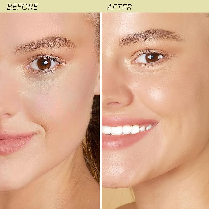 Hyaluronic Acid Moisturizer for Face - USA Made with Organic & Natural Ingredients, Hydrating Anti Aging Face Moisturizer for Dry Skin with Glycerin & Vitamin E, Unscented Anti Wrinkle Cream-GlimoraGlow