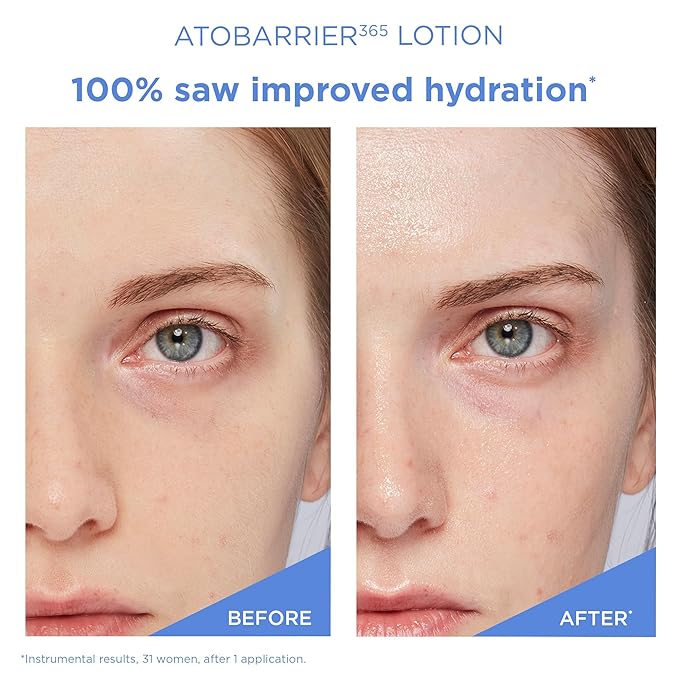 AESTURA ATOBARRIER365 Lightweight Cream + Facial Mist-GlimoraGlow