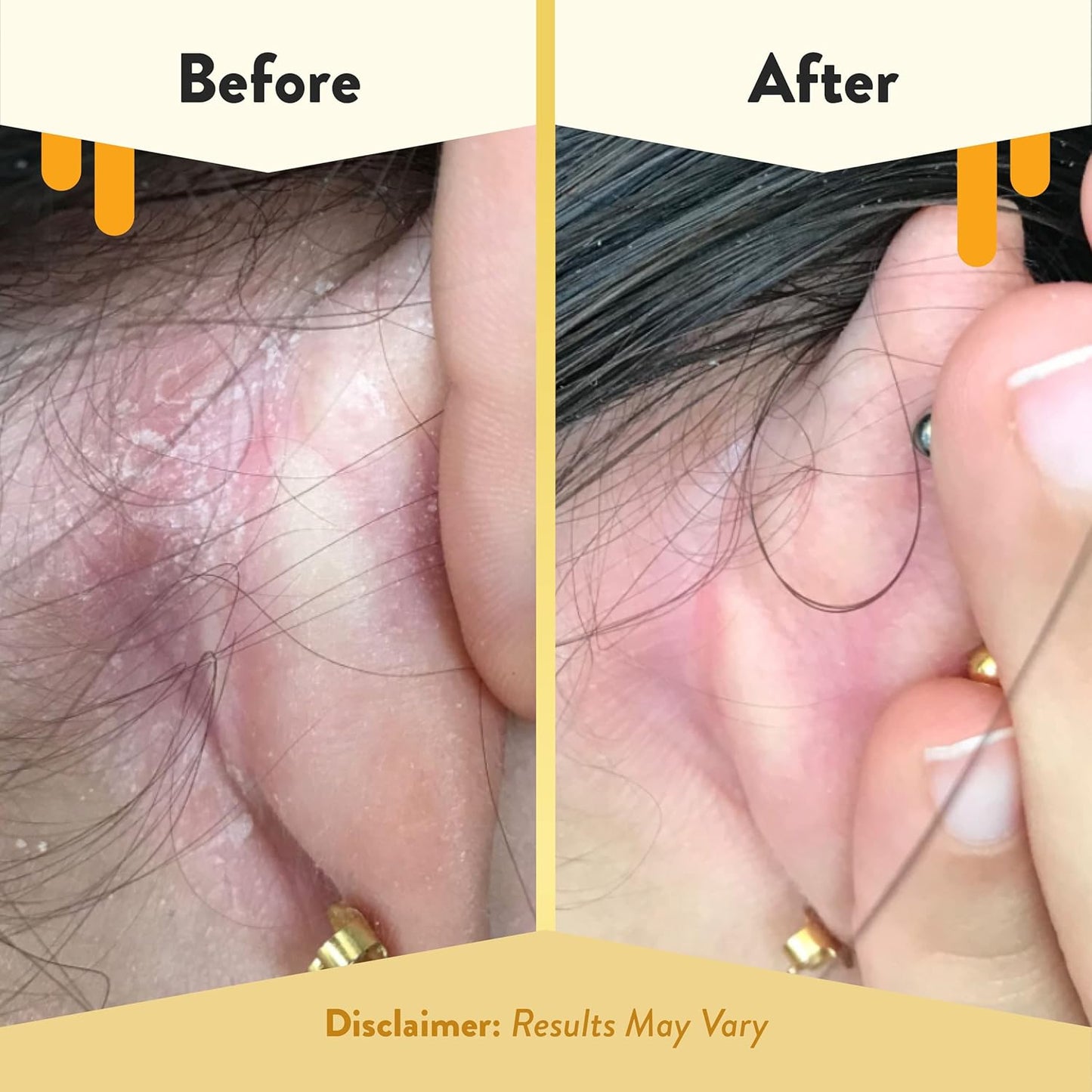 ECZEMA HONEY Gentle Face & Body Lotion Stick - Moisturizing Colloidal Oatmeal Hand Cream for Extremely Dry Skin - Eczema Lotion Helps Psoriasis, Dermatitis & More (2.2 Oz)-GlimoraGlow