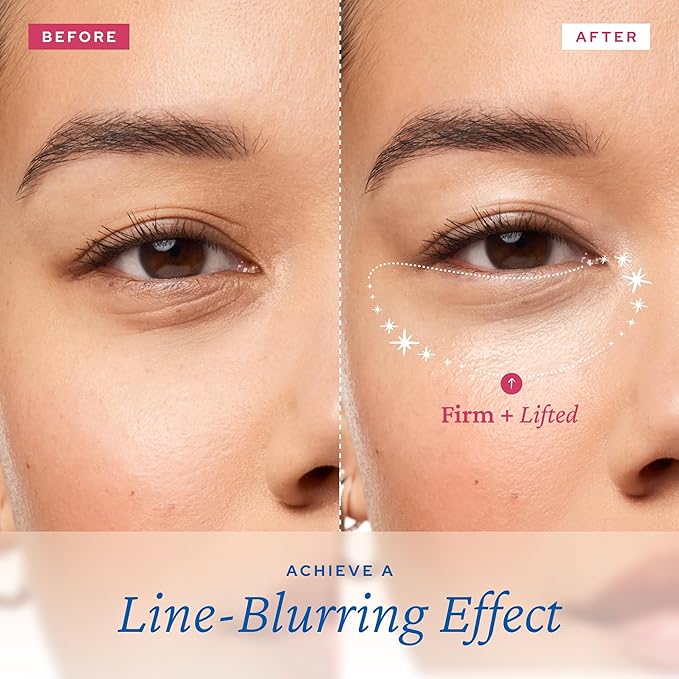 belif Aqua Bomb Lifting Eye Gel | Retinol + Collagen + Peptide for Firming & Plumping | Hyaluronic Acid for Glowy Hydration | Niacinamide for Dark Circles | Korean Skin Care-GlimoraGlow