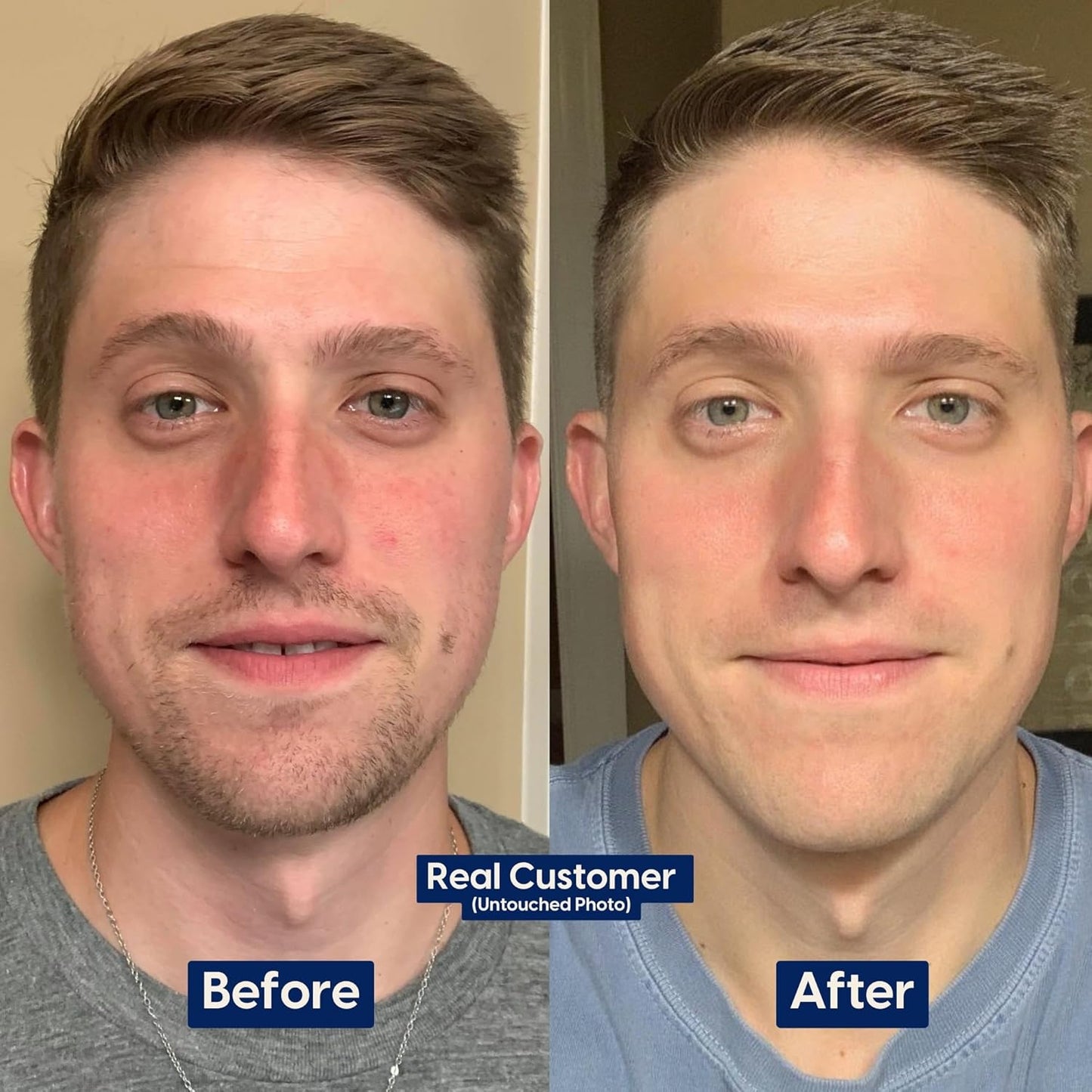 Strive Mens Face Moisturizer, Dark Circle Brightening, Anti Aging Mens Face Lotion with 4% Niacinamide+, Hyaluronic Acid & Ceramides, Hydrating Fragrance Free Skin Care Face Cream - 1.7 fl oz.-GlimoraGlow