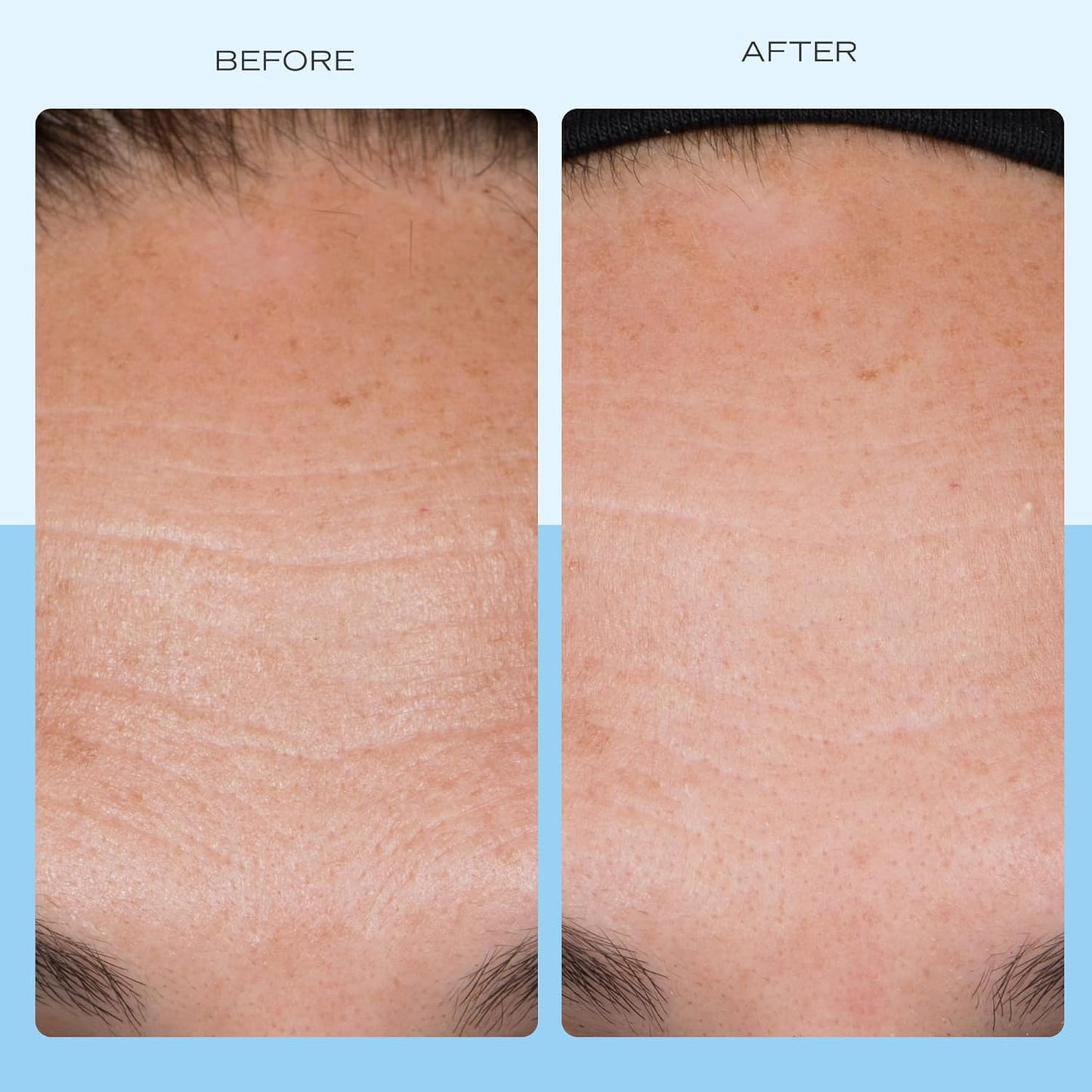 First Aid Beauty - Firming Collagen Cream with Peptides & Niacinamide, Ultra-Rich Plumping Moisturizer, Hydrates & Visibly Firms, Non-Comedogenic, Safe for Sensitive Skin, 3.5 oz-GlimoraGlow