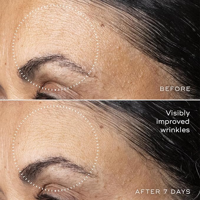 Medik8 C-Tetra Advanced - Balancing, Plumping, Hydrating Daily Vitamin C Serum with Hyaluronic Acid, Squalene - Smooths Fine Lines, Wrinkles - 1.0 oz-GlimoraGlow