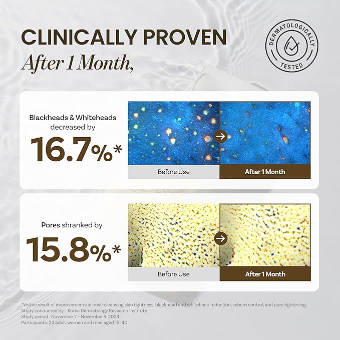 ONGREDIENTS Skin Barrier Moisture Deep Cleanser | Daily Face Wash for All Types | Centella, Peptide, AHA, LHA, Hydrating, Soothing, Pore Tightening | Vegan, Korean Skin Care 4.06 fl Oz-GlimoraGlow