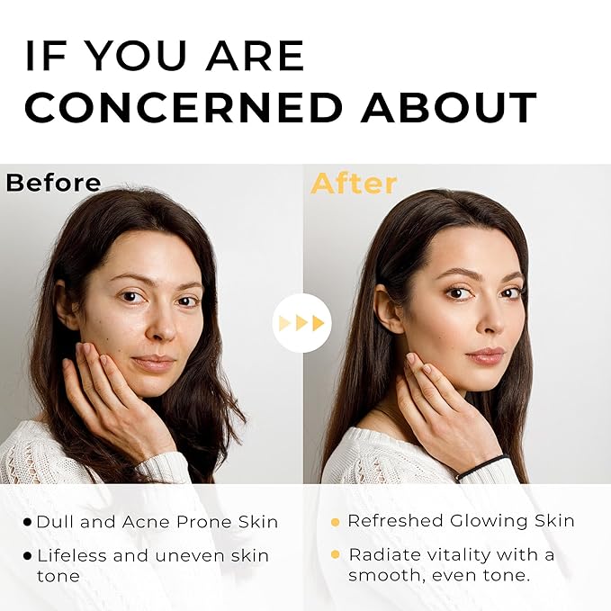 Italian White Truffle Spray Serum - Vegan Skin Care - Face Mist Hydrating Spray with Avocado & White Truffles - Face Serum for Radiant Skin - 3.38 Fl Oz-GlimoraGlow