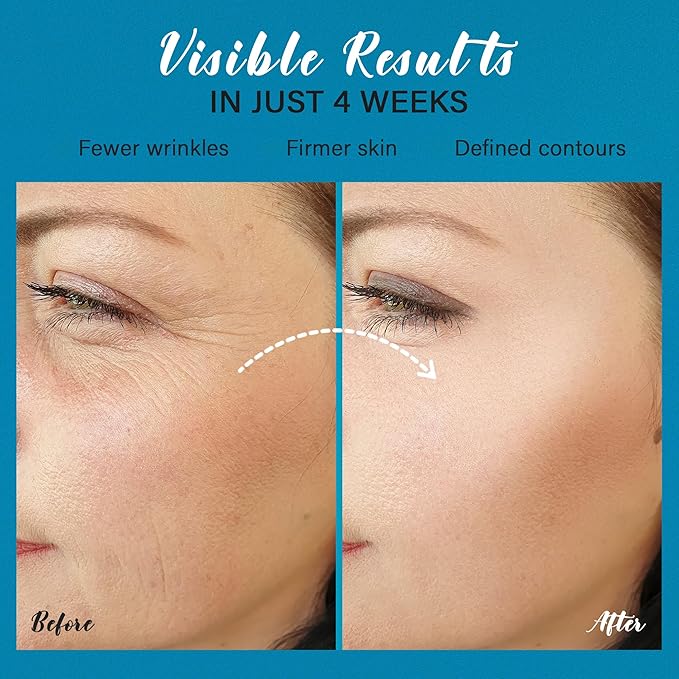 Tighten and Lift Neck Cream: Instant Face Lift Cream - 6-in-1 Anti-Aging Face Moisturizer for Anti-Wrinkle, Firm - Collagen, Retinol, Peptides & Hyaluronic Acid Neck Firming Cream for Skin Care-GlimoraGlow