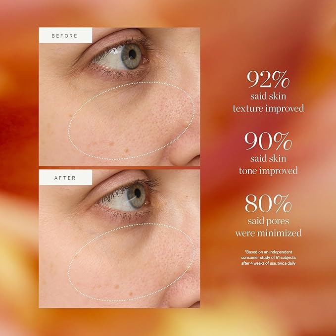 KORA Organics Turmeric Glow Drops, Niacinamide Alternative Face Serum for Radiance, Texture and Pore Appearance, Certified Organic, Vegan, 0.34 fl oz-GlimoraGlow