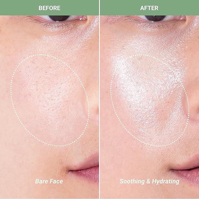 Meebak CICA Toner Spray | Korean Face Mist | Facial Spray with Centella Asiatica & Vitamin E | Soothing Face Toner for Sensitive, Oily, and Combination Skin | 4 fl oz-GlimoraGlow