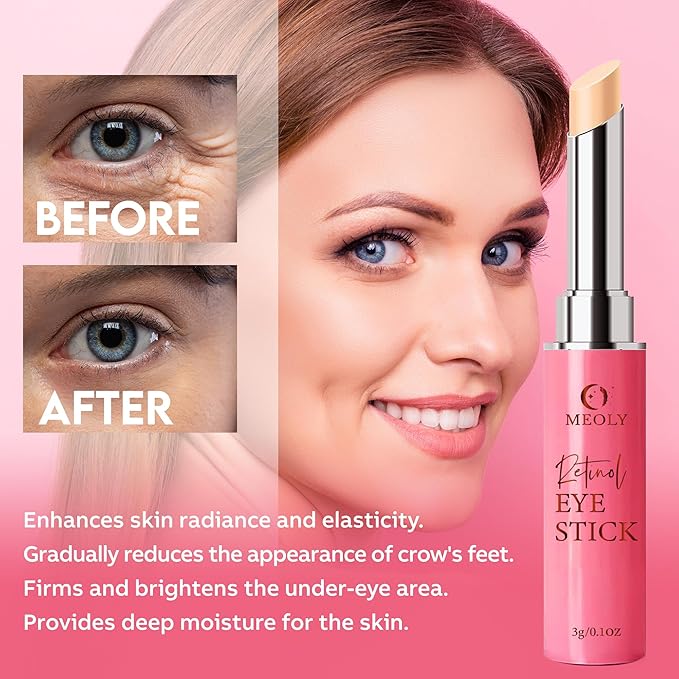 Instant Eye Bag Remover, Retinol Eye Cream for Dark Circles, Under Eye Brightener Stick, Under Eye Cream Anti Aging, Eye Cream for Wrinkles, Brightening Eye Cream for Puffiness and Bags-GlimoraGlow