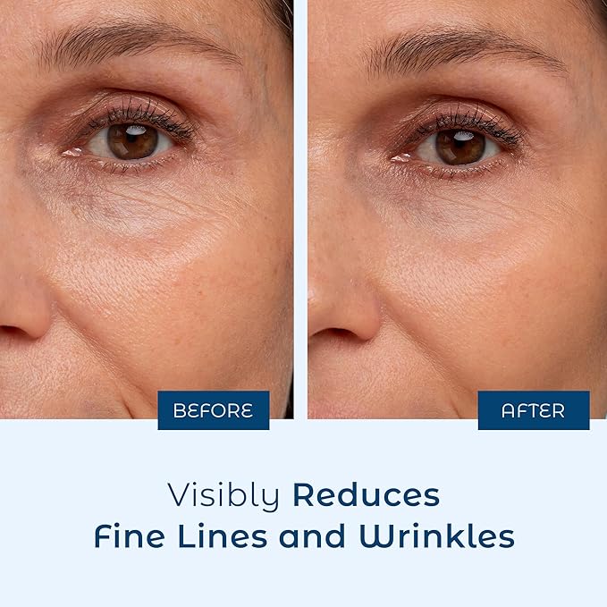 Cosmedica Skincare Hyaluronic Acid Serum, 1 Fl. Oz-GlimoraGlow