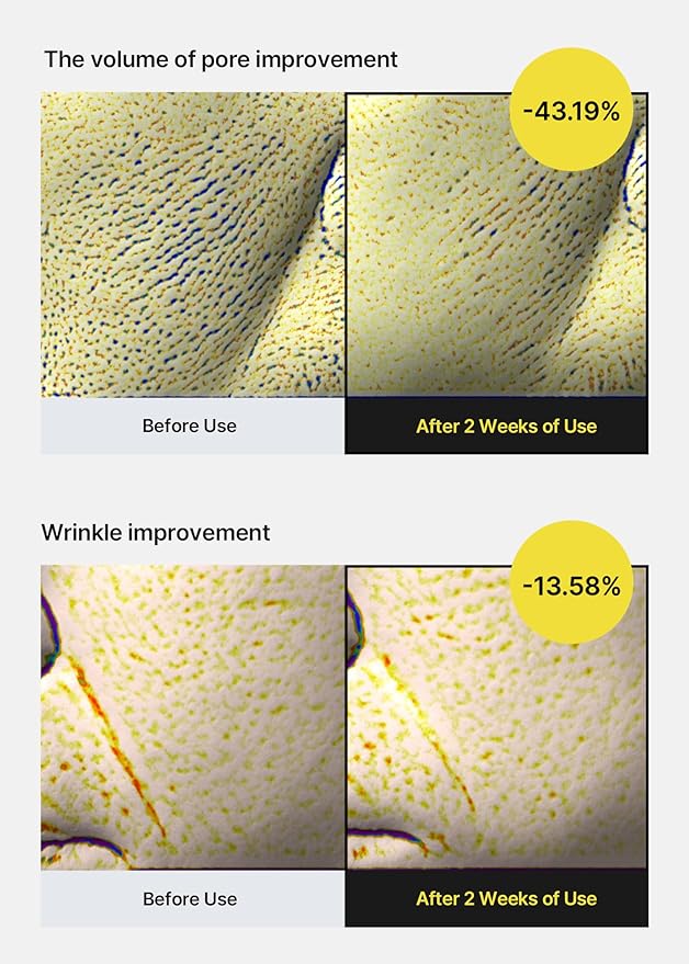 celimax The Vita A Retinol Shot Tightening Serum | with Pure Vitamin A Retinol, Peptide, Pore Minimizer, Wrinkles & Fine Lines, Firmer Skin, Anti-Aging, Skin Smoothing 30ml-GlimoraGlow