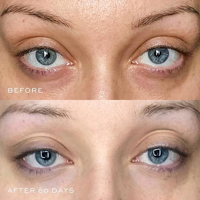 DIME Beauty Luminosity Eye Serum, Eye Cream for Dark Circles and Puffiness, Caffeine Eye Cream, Puffy Eyes Treatment, 0.5 oz / 15 mL-GlimoraGlow