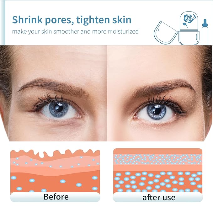 Ice Roller for Face,Ice Face Roller Skin Care ,Face Ice Pack Ice Facial and Eyes Cube Massager tools.Contains Essence Set (Set-Purple)-GlimoraGlow