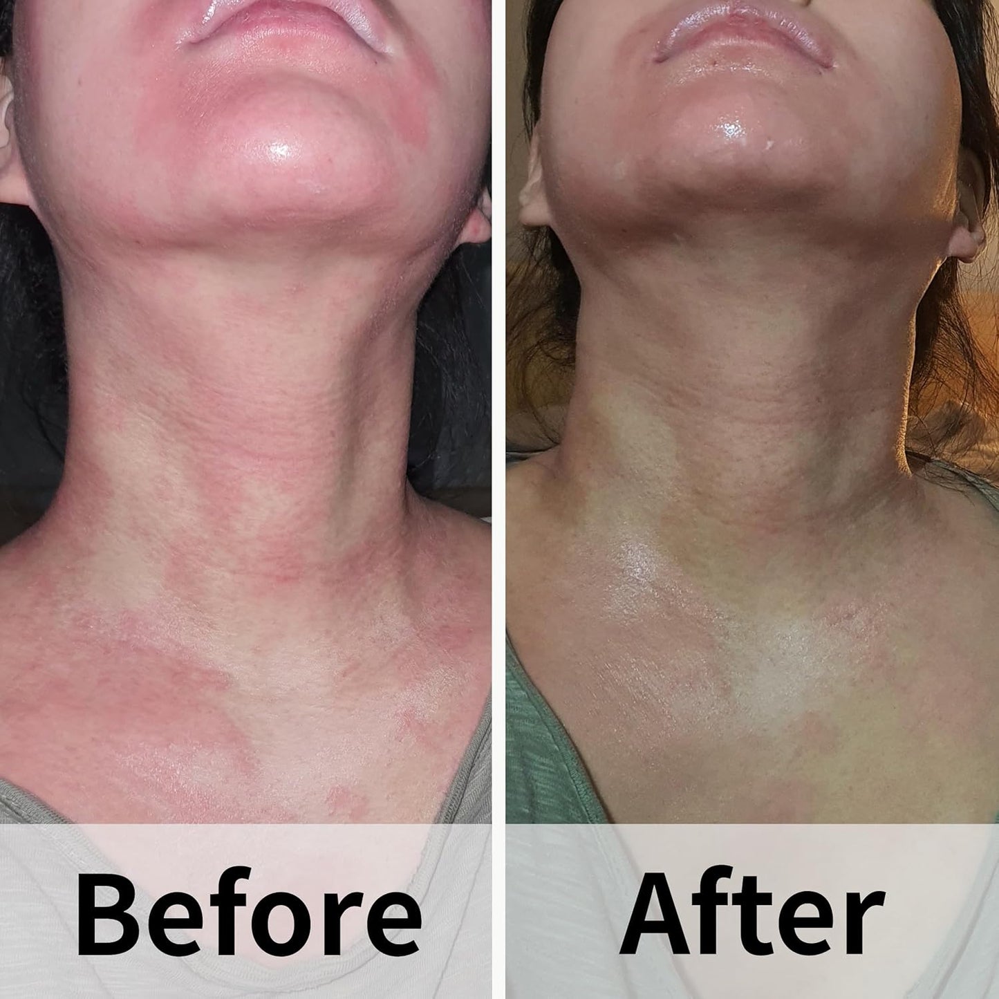 Ato Fast Calming Serum for Sensitive & Eczema-Prone Skin Instant Relief from Itch, Redness & Flare-Ups Powered by Cica & Panthenol 1.69 Fl Oz-GlimoraGlow