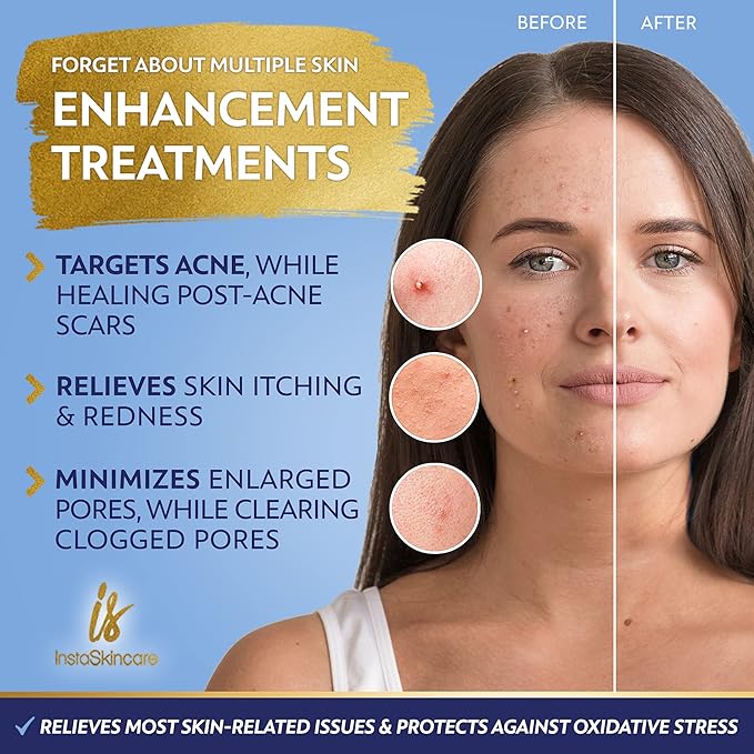 DOUBLE SIZED (2Oz) Niacinamide Serum for Face 10% with Zinc 1% Vitamin B3 Brightening Serum for for Tone, Texture and Hydrating-GlimoraGlow