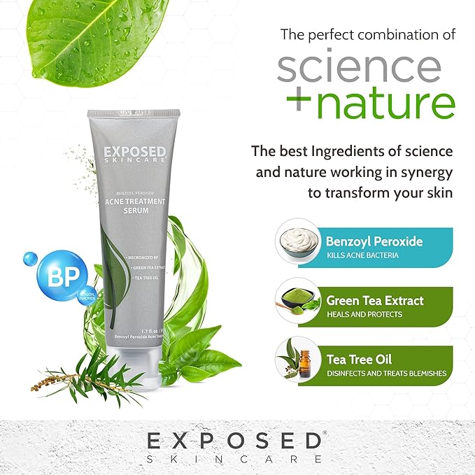 Exposed Skin Care Acne Treatment Serum Step 3 – Quickly Reduces Pimple Size and Redness - 12 Hour Spot Treatment - 3.5% Benzoyl Peroxide, Natural Green Tea & Tea Tree Oil-GlimoraGlow