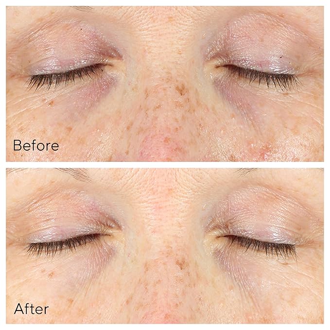 Murad Vita-C Eyes Dark Circle Corrector – Environmental Shield Vitamin C Brightening Serum – Anti-Aging Treatment for Puffiness and Wrinkles, 0.5 Fl Oz-GlimoraGlow