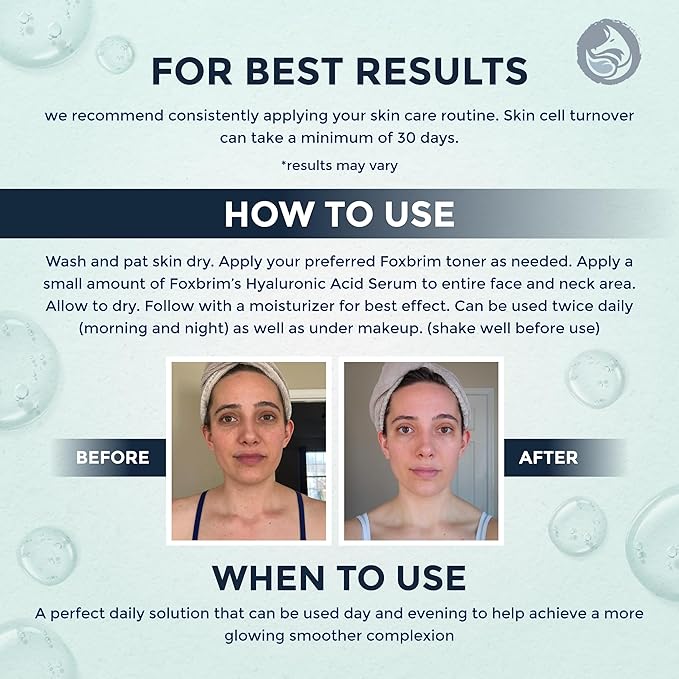 Hyaluronic Acid Face Serum - Hydrating Anti Wrinkle Anti Aging Facial Serum - With Vitamin C and E, Green Tea, Jojoba Oil - Natural and Organic - 1 Oz by Foxbrim Naturals-GlimoraGlow