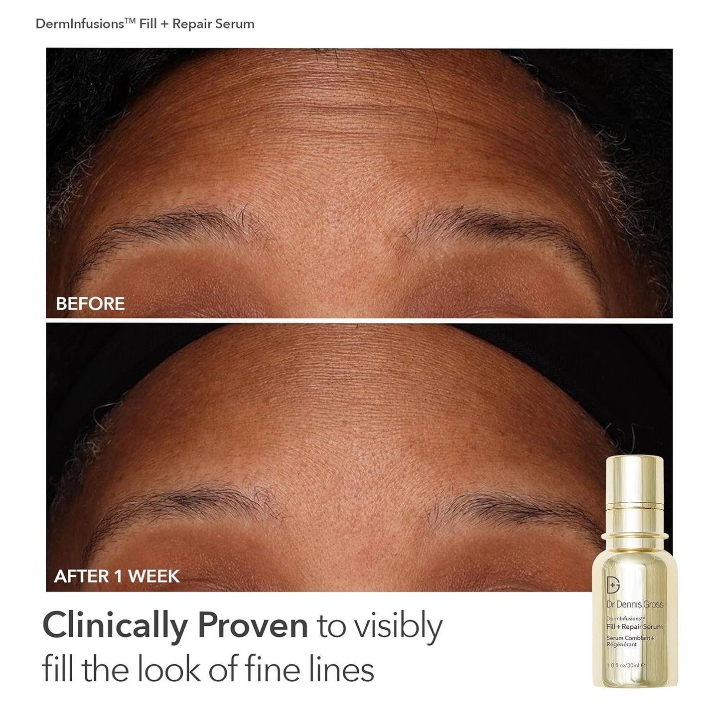 Dr. Dennis Gross Fill, Plump & Firm Kit – DermInfusions™ Hyaluronic Acid Serum, Eye Cream & Lip Treatment | Boost Hydration, Smooth Fine Lines & Enhance Volume | Limited Edition Gift Set-GlimoraGlow