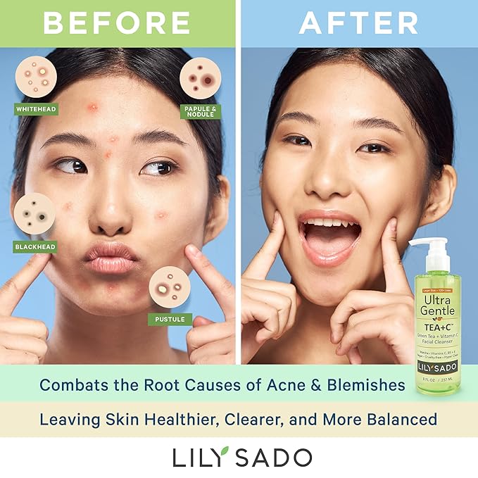 LILY SADO TEA+C™ Green Tea & Vitamin C Face Cleanser – Natural Vegan Antioxidant Daily Face Wash with Aloe, Rosehip, Meadowfoam - Gentle Deep Cleansing for Acne, Blackheads, Blemishes. 8 oz-GlimoraGlow
