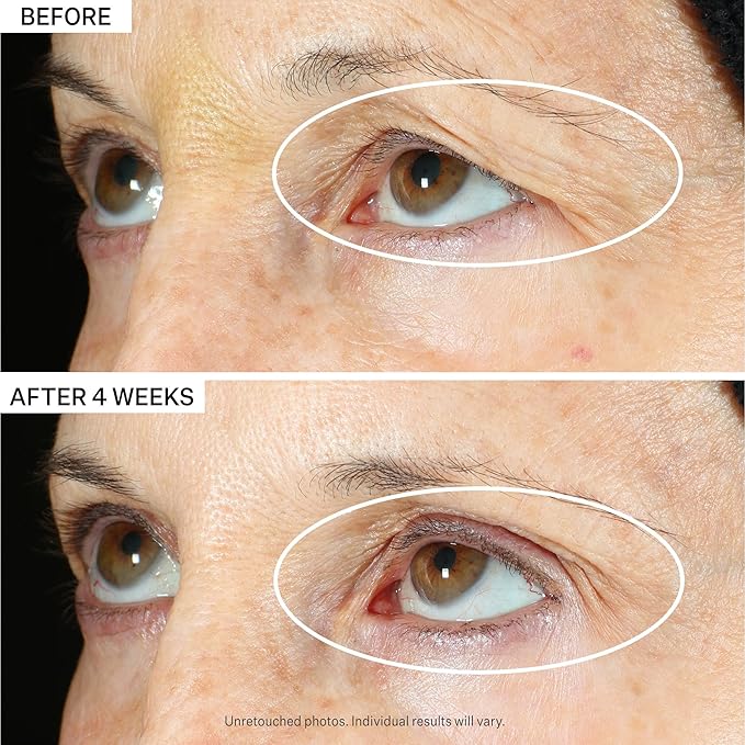 StriVectin Tighten & Lift Peptight 360 Degree Eye Serum with Tightening & Brightening Peptides for Wrinkles, Under Eye Bags and Puffiness, 1 fl. Oz-GlimoraGlow