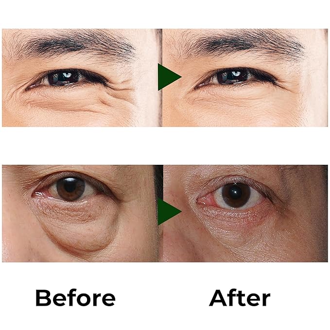 Abera Eye Roller Serum with Mint Essence, Vitamin C and Peptides - Energizing Serum for Dark Circles and Puffiness, Fine Lines Serum, 0.34 fl oz-GlimoraGlow