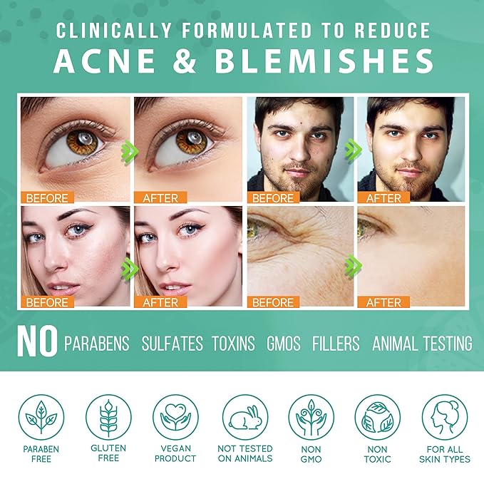 LILY SADO TEA+C™ Green Tea & Vitamin C Face Cleanser – Natural Vegan Antioxidant Daily Face Wash with Aloe, Rosehip, Meadowfoam - Gentle Deep Cleansing for Acne, Blackheads, Blemishes. 8 oz-GlimoraGlow