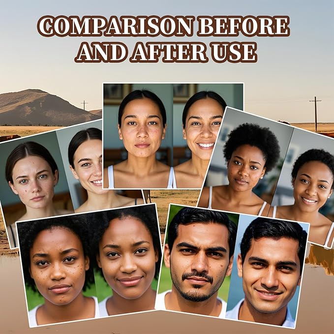 Beef Tallow for Skin, Tallow and Honey Balm, Facial Moisturizer Cream, 100% Organic Grass Fed Whipped Beef Tallow Balm Deeply Moisturizing for Face & Body, Suitable For All Skin Types(3.53oz)-GlimoraGlow