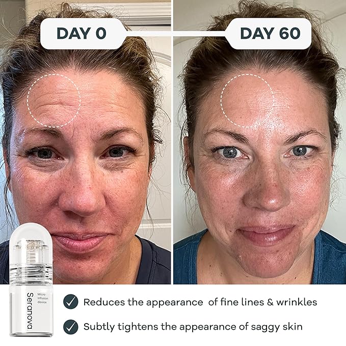 Seranova - Micro Infusion for Skin Care (2-Month Supply)-GlimoraGlow