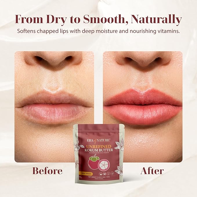 era of nature Kokum Butter Raw - 16 oz (1lb) - Natural Butter for Body Butters, Lotion Bars, Lip Balm, Soap Making – Blends Well with Shea or Cocoa Butter – For Stretch Marks, Scars, Pregnancy Care-GlimoraGlow