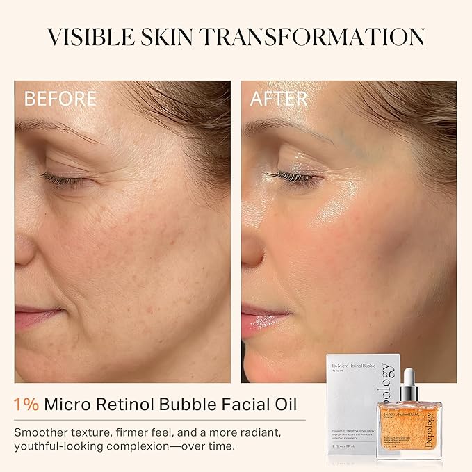 1% Retinol Face Oil with Firming, Smoothing & Glowing– Retinol Serum for Face, Lightweight Squalane Facial Oil for Fine Lines, Texture & Anti-Aging, Gentle for All Skin 1.01 fl oz-GlimoraGlow