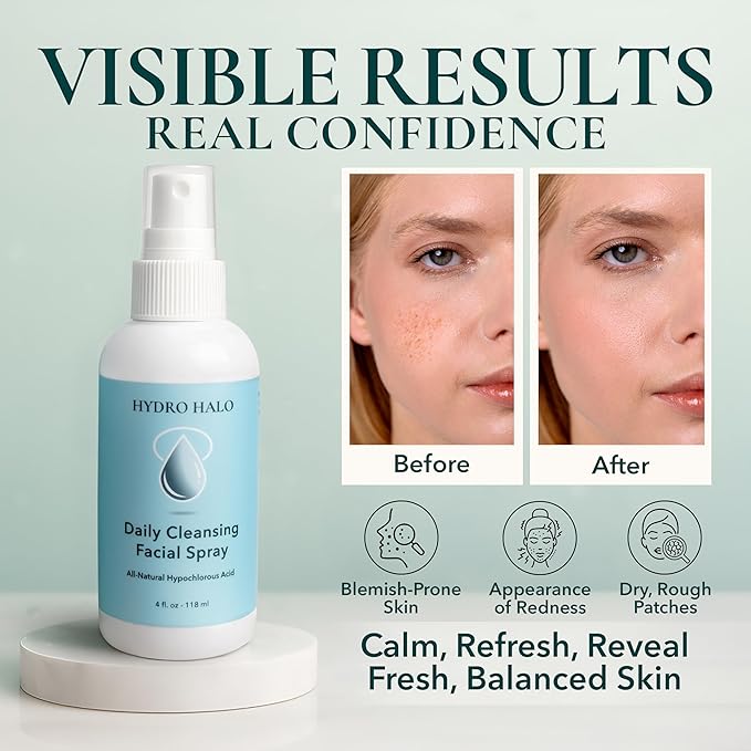 Hypochlorous Acid Spray for Face 4oz – Pure Hypochlorous Acid Spray Cleaner, Daily Cleansing Facial, pH Balanced, Plant Based, No Alcohol, USA Made-GlimoraGlow