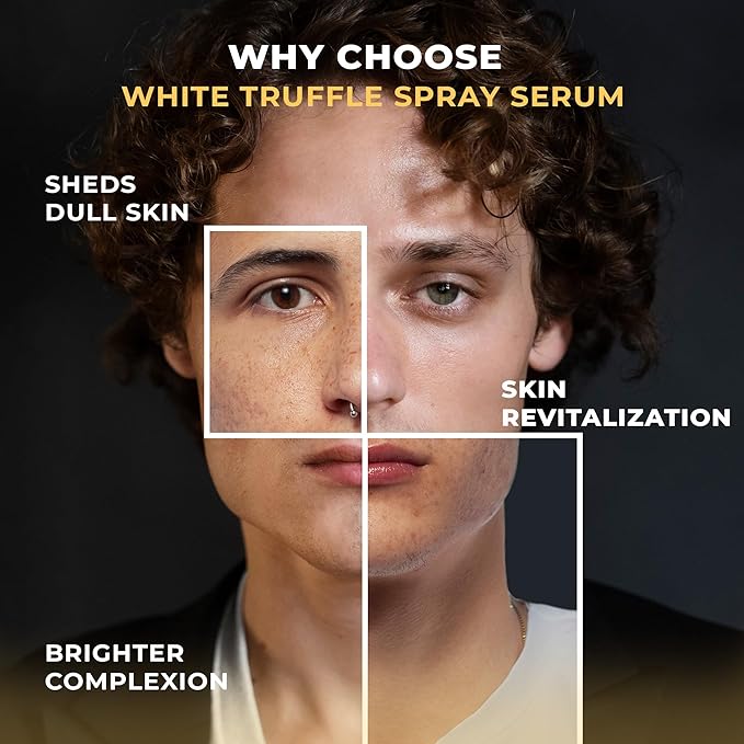 Italian White Truffle Spray Serum - Vegan Skin Care - Face Mist Hydrating Spray with Avocado & White Truffles - Face Serum for Radiant Skin - 3.38 Fl Oz-GlimoraGlow