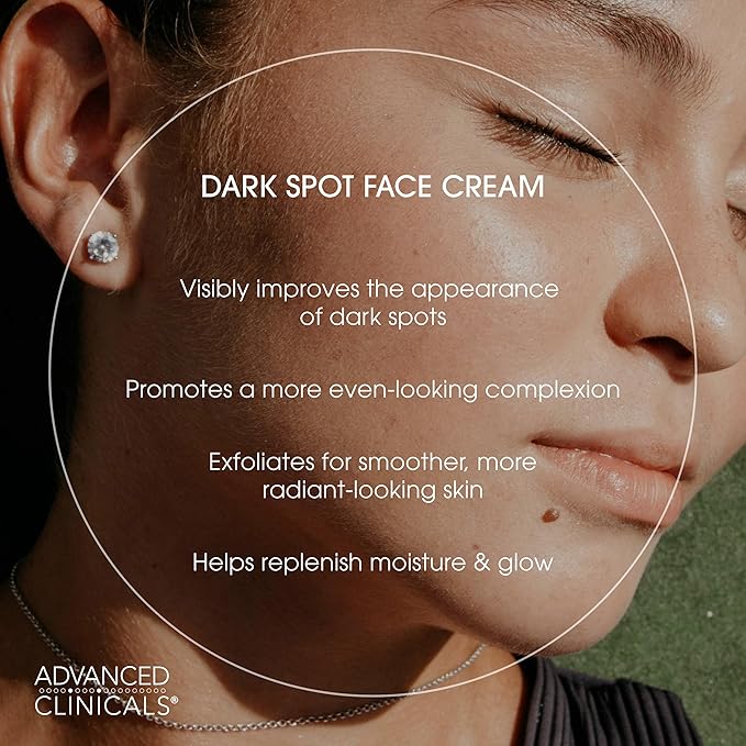 Advanced Clinicals Dark Spot Face Moisturizer | Lactic Acid Lotion For Face With Caffeine, Cocoa Butter, & Vitamin A | Brightening Cream Visibly Reduces Look Of Dark Spots & Uneven Skin Tone, 2 Fl Oz-GlimoraGlow
