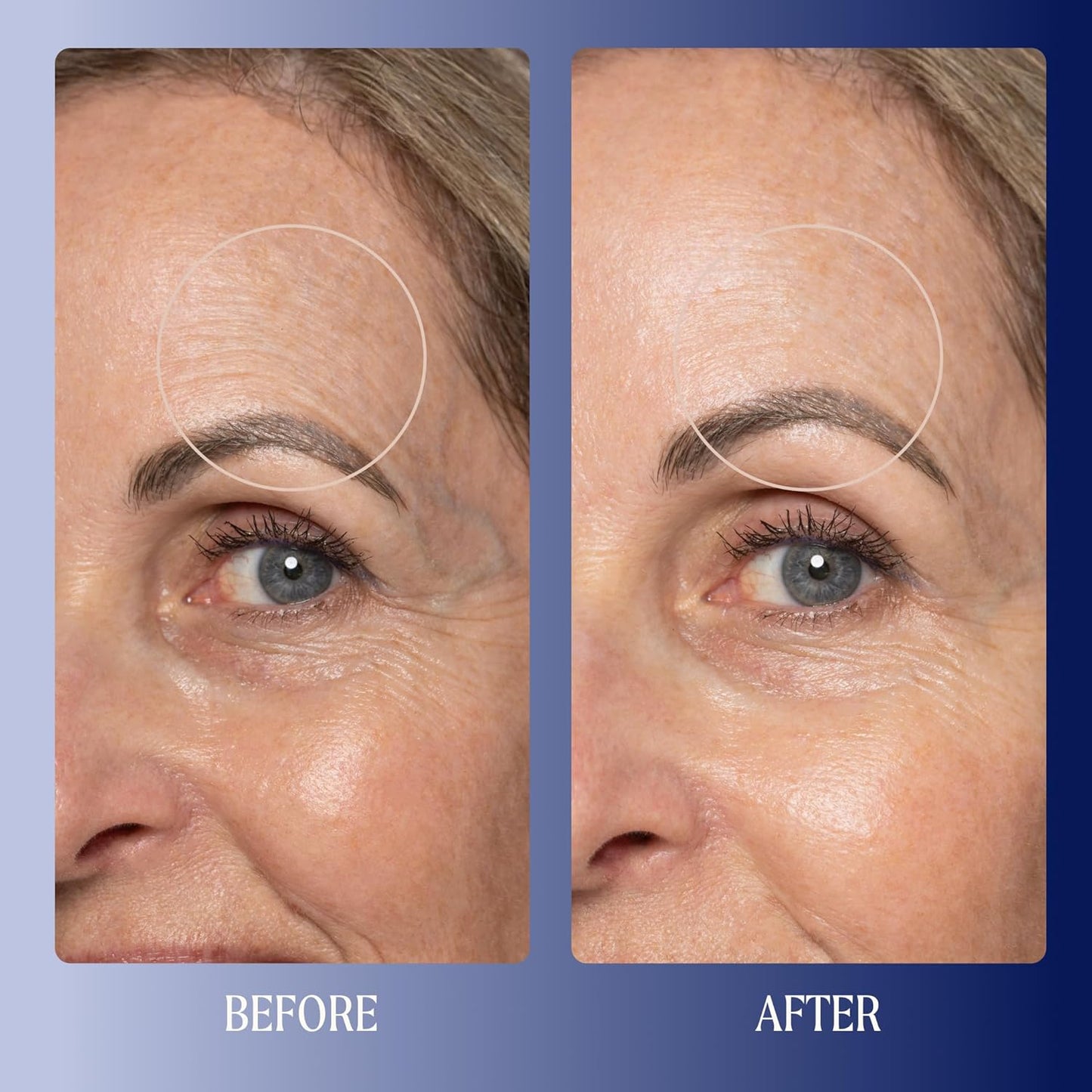 Kinship Super Rich Collagen + Ceramide Firming Cream | Anti Aging, Hydrating Face Moisturizer for Sensitive Skin | Wrinkle Cream - Smooth Fine Lines | Synthetic Fragrance-Free | Derm Approved, (1.7oz)-GlimoraGlow