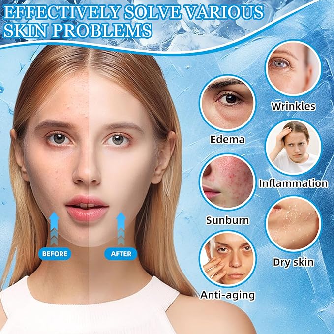 Ice Face Roller Massager for Face, Reusable Silicone Ice Cube Mold, Facial Beauty Ice Roller, Reduce Puffiness and Dark Circles, Minimize Pores & Improve Skin Texture (Black)-GlimoraGlow