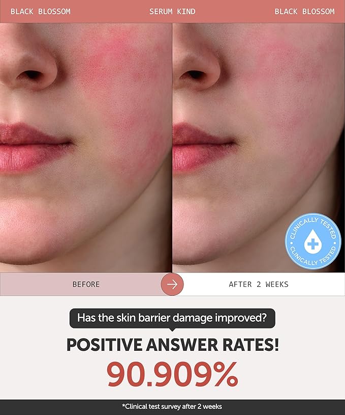 SERUMKIND Black Tulip Serum - Barrier Repair Antioxidant Korean Face Serum – Beta Glucan – Hydrating and Anti-aging – Vegan, Cruelty-Free, Unscented – 1.01 fl.oz.-GlimoraGlow