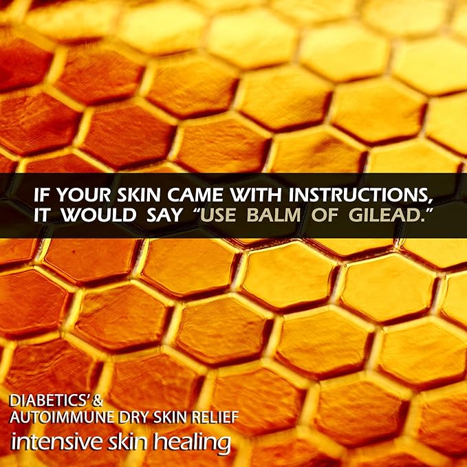 BALM OF GILEAD Neuropathy Frankincense & Sweet Myrrh Therapeutic Rubbing Oil - Instant Diabetic's & Autoimmune Dry Skin Relief & Repair, 2 fl oz-GlimoraGlow