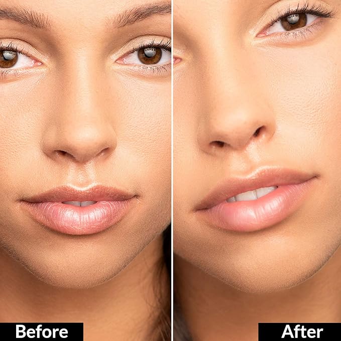 True + Luscious Flowerdose Lip & Eye Serum – 2-in-1 Lip Plumping & Eye Serum for Dry Lips and Dark Circles – Intensely Hydrating, Anti-Aging Formula – 0.5 oz-GlimoraGlow