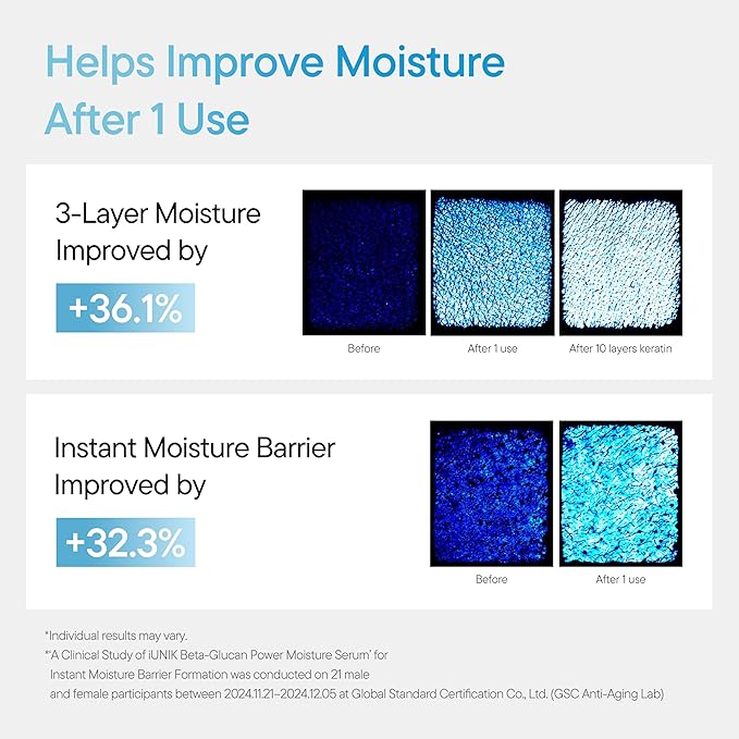 IUNIK Beta-Glucan Power Deep Moisture Vegan Serum Intense Hydration Mushroom Yeast Extracts Naturally-derived - Dry Mature Sagging Sensitive Skin Cell Regenerating Lifting Korean Skincare-GlimoraGlow