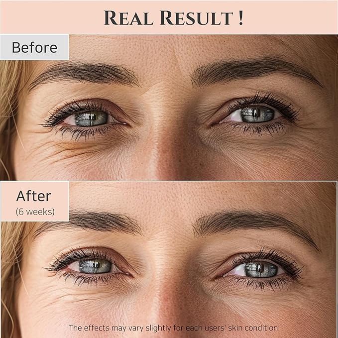 Beauty of Joseon Revive Eye Serum with Retinal Niacinamide Peptide for Face Under Eyes Wrinkles Dark Circles Moisturizer Cream Korean Skincare 30ml, 1 fl.oz * 2pack-GlimoraGlow