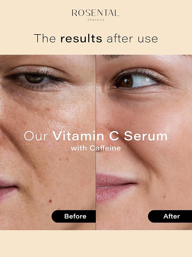 Organics Vitamin C Serum with Caffeine (30ml) – Hydrating Face Serum for Dark Spots, Acne Scars, Wrinkles – Brightening & Anti-Aging Facial Care – Natural Cosmetics – Made in Germany-GlimoraGlow