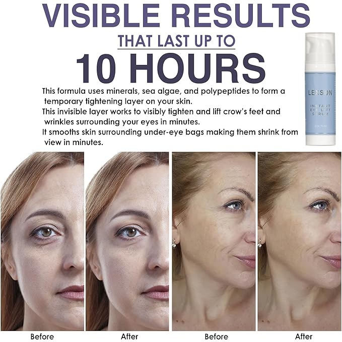 Instant Eye Lift Serum - Provides Immediate Visible Results, Lifts Away Appearance of Lines & Wrinkles. Dark Circles Under Eye Treatment, Eye Cream for Dark Circles and Puffiness-GlimoraGlow
