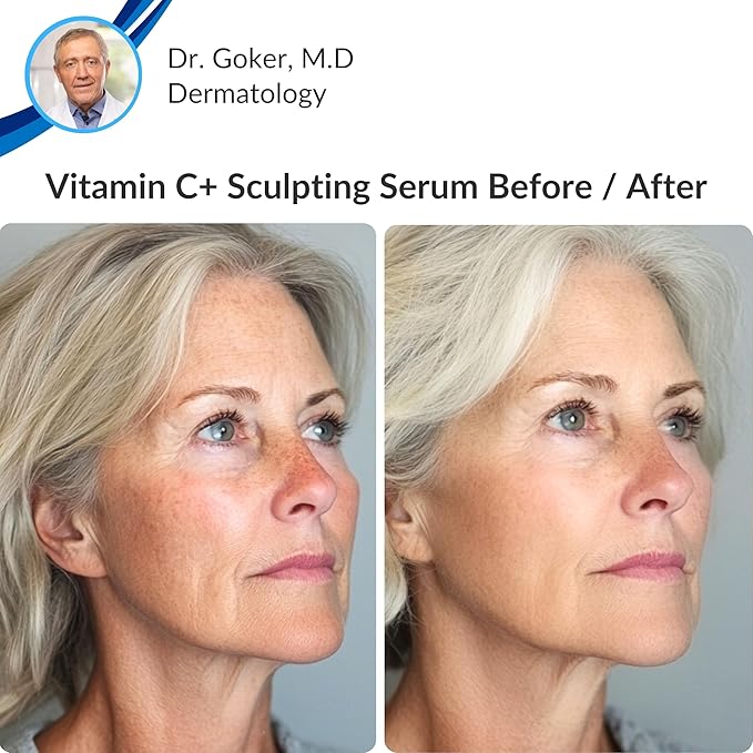 LeVaye Vitamin C Serum, Anti-Aging Face Serum – 15% Vitamin C, Ferulic Acid, Niacinamide, Hyaluronic Acid, Peptides, Ceramides – Targets Wrinkles, Fine Lines, Dark Spots, Enlarged Pores, Dry Skin-GlimoraGlow